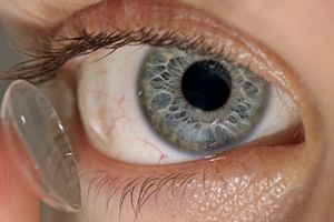 Photograph: www.eyedoctorguide.com